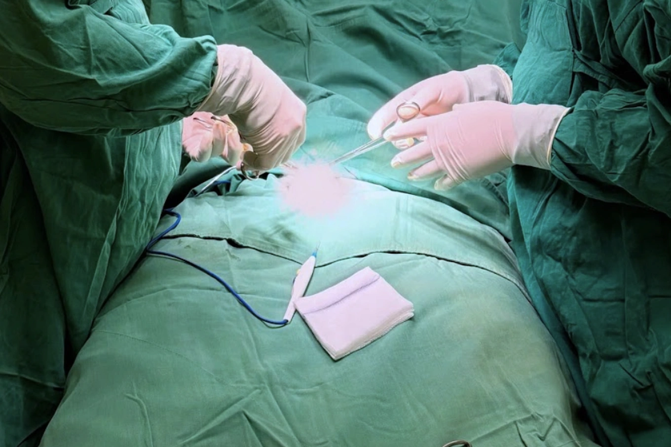 Year-Long Testicular Pain Leads to Surprise Diagnosis of Rare Disease